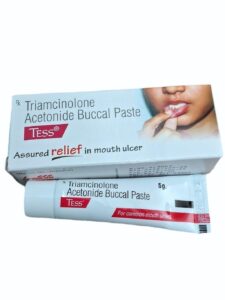 TESS BUCCAL PASTE